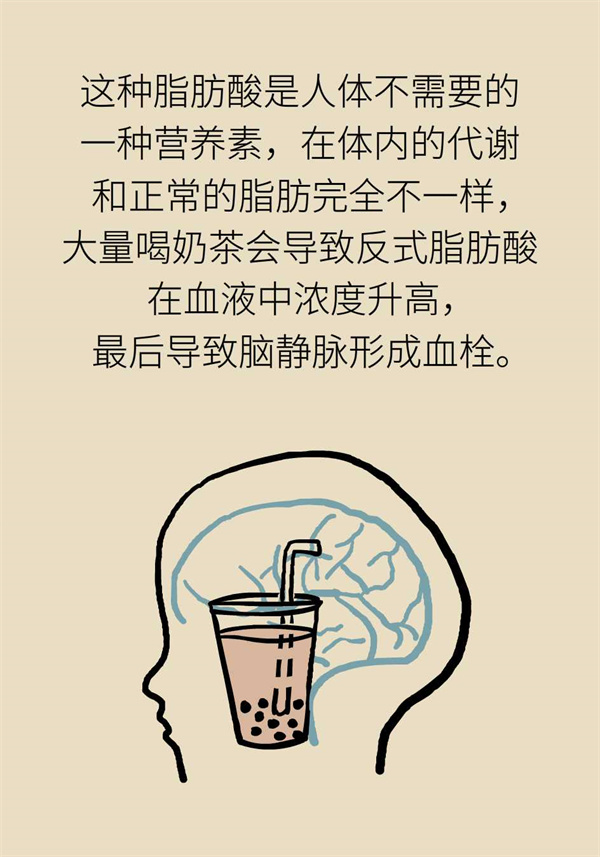 脑静脉血管栓塞使人晕厥，只因奶茶喝得太频繁？